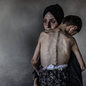 gazze seridinde son 24 saatte 5 filistinli daha acliktan hayatini kaybetti 93wij4Wc